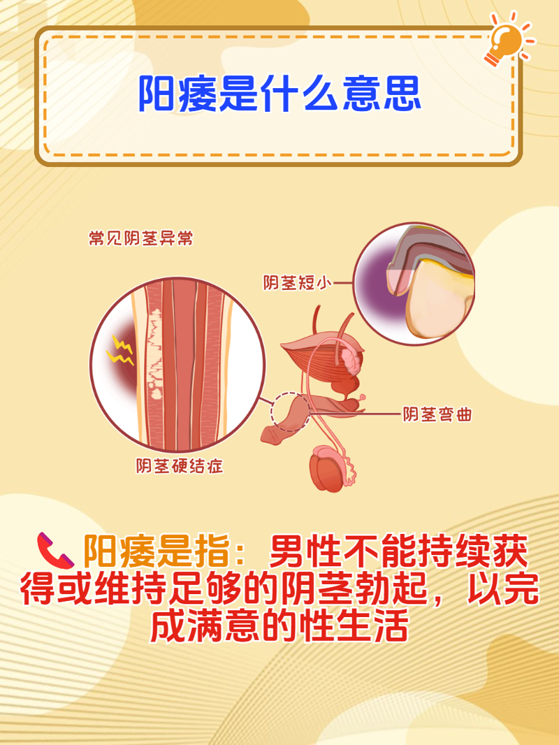 泌尿系结石有哪些？了解这些知识对预防很重要！