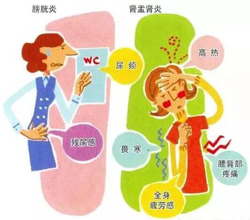 泌尿系结石包括哪些？——从案例出发，揭示常见类型