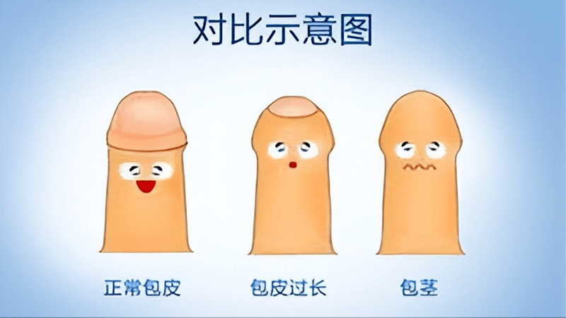 前列腺炎是男性常见疾病之一，面对这个问题，很多人都想知道哪一种药物能够快速有效。今天我们就来对比分析几种常用的治疗方法。